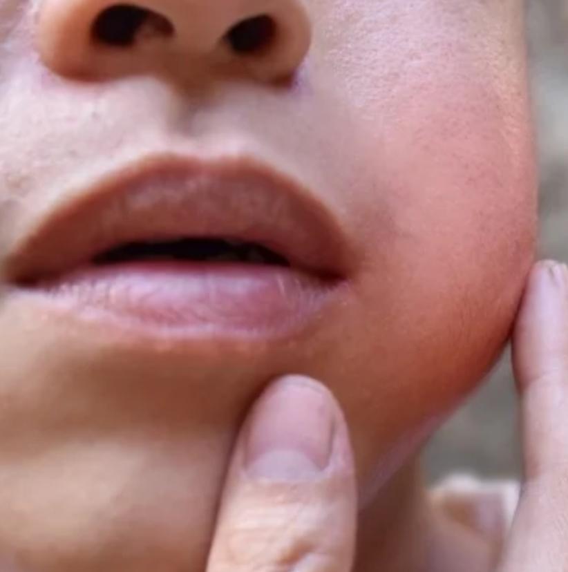 Trauma dentário com necessidade de atendimento imediato